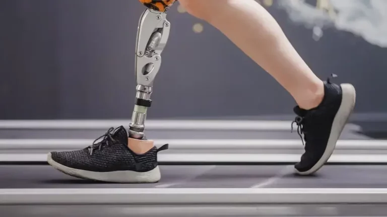 The Affordability Challenge: Breaking Down Cost Barriers to Prosthetic Legs